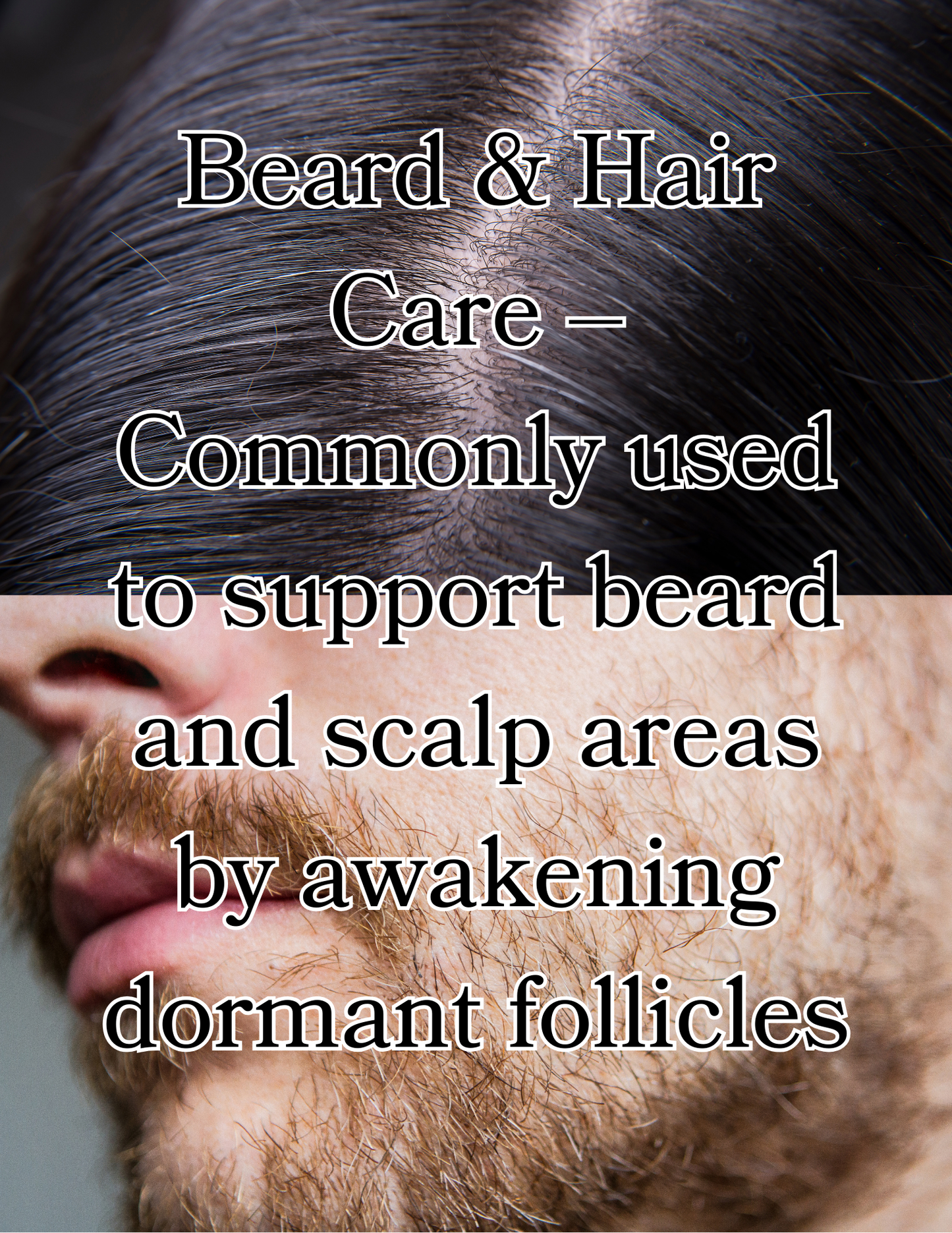 0.25 mm Beard & Skin Derma-Roller