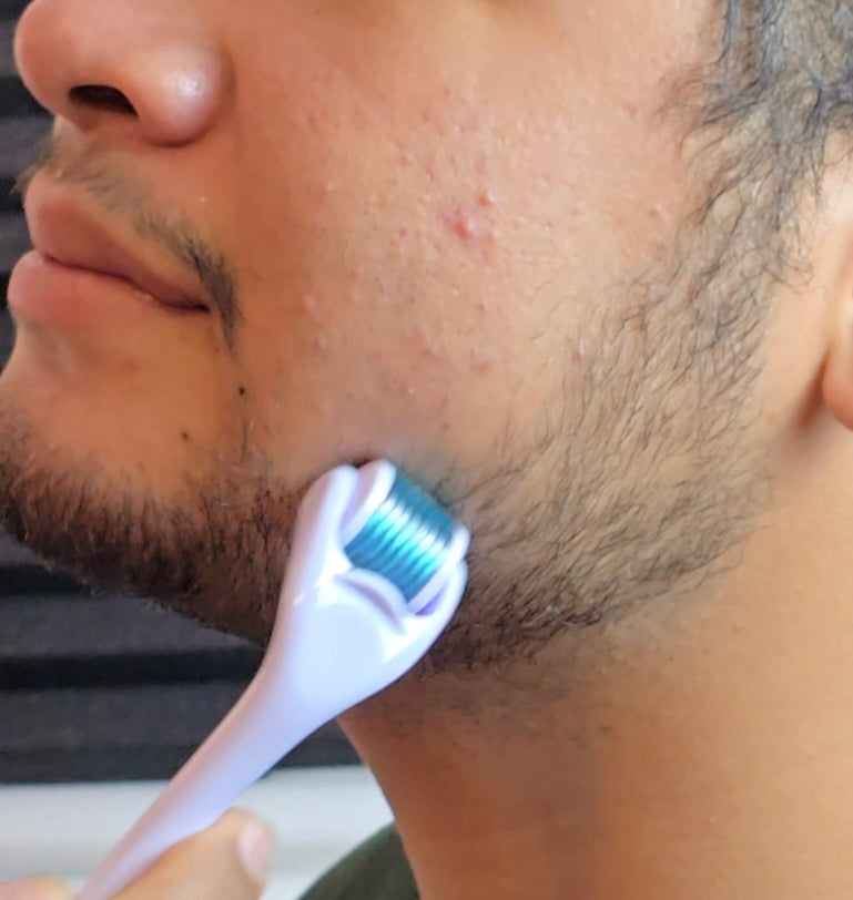 0.25 mm Beard & Skin Derma-Roller